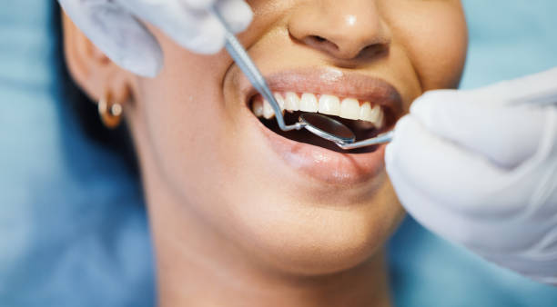 Best Emergency Dental Care for Broken or Chipped Teeth in Long Prairie, MN