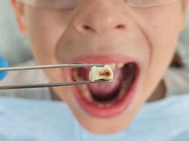 Best Emergency Denture Repair in Long Prairie, MN